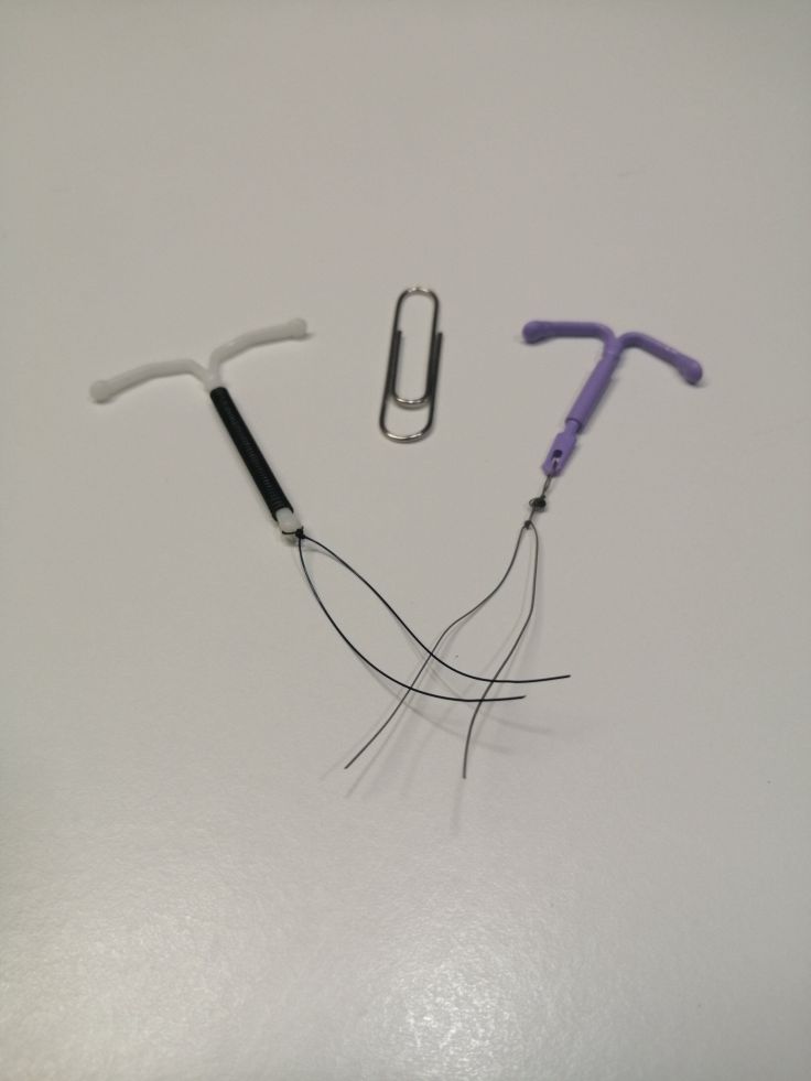 El DIU, ¿hormonal o de